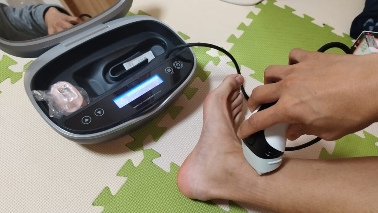 ケノンで足を照射