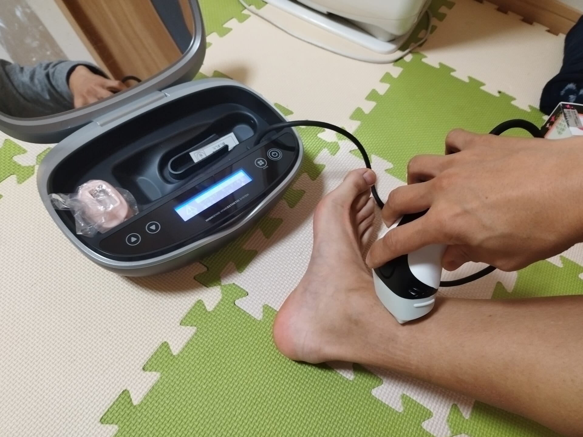 ケノンで足を照射